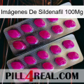 Imágenes De Sildenafil 100Mg 10